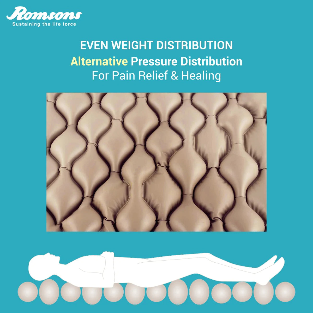 Nosor Bubble Mattress Bed Sore Prevention Kit