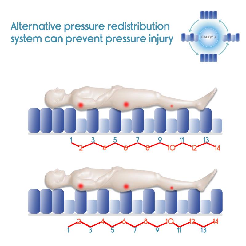 KosmoCare Anti Decubitus Bubble Air Mattress MM1 for prevention of bed/pressure sores